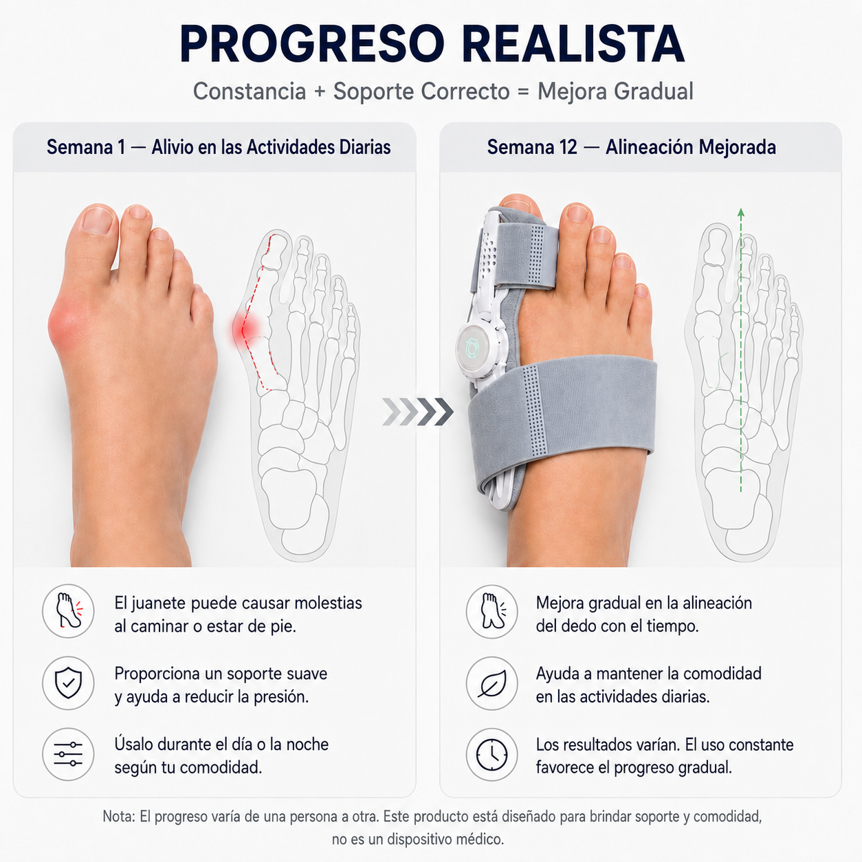 VERTIX - Corrector De Juanetes