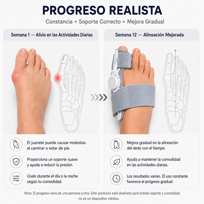 VERTIX - Corrector De Juanetes